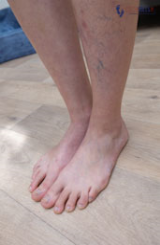 example image